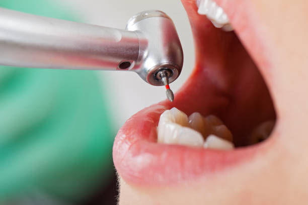 Best Emergency Gum Treatment in Beach Park, IL